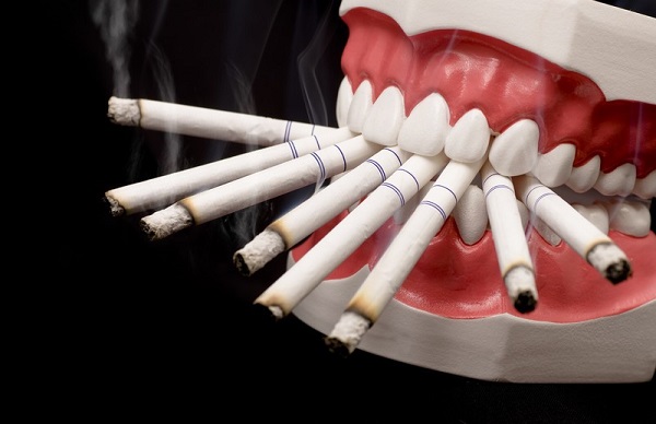 smoking-effect-avenue-dental1